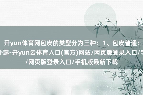 开yun体育网包皮的类型分为三种：1、包皮普通：龟头不错十足外露-开yun云体育入口(官方)网站/网页版登录入口/手机版最新下载